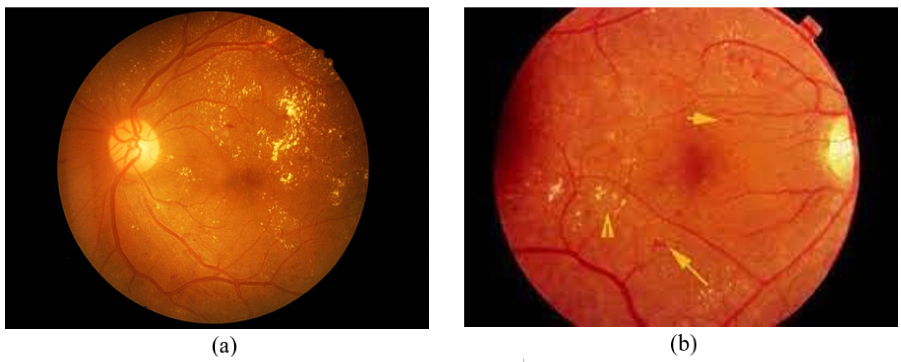 Figure 3 from the Ophthalytics paper: retinal fundus images